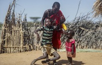 Hơn 18 triệu người ở vùng Sừng châu Phi đối mặt với mất an ninh lương thực nghiêm trọng