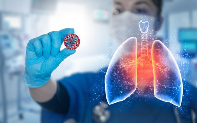 Nguy cơ mắc bệnh lao phổi ở bệnh nhân COVID-19 cao gấp 7 lần
