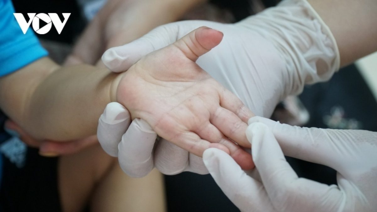 Việt Nam nhận số lượng lớn thuốc điều trị bệnh tay chân miệng