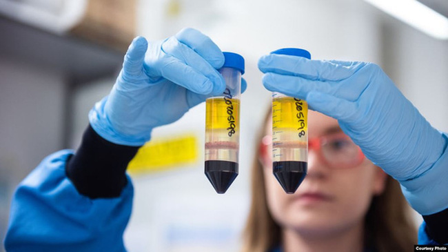 Vaccine của Astrazeneca vừa ngăn bệnh, vừa giảm truyền virus