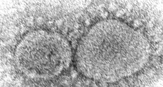 Biến thể mới tại Brazil có thể tái nhiễm cho những người đã khỏi bệnh trước đó