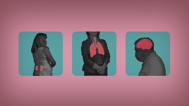 3 giả thuyết về nguyên nhân, triệu chứng và tác động của hội chứng “COVID kéo dài”