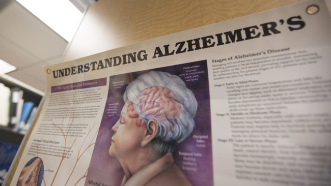 Số người mắc chứng sa sút trí tuệ dự kiến tăng 40%, lên 78 triệu người vào năm 2030