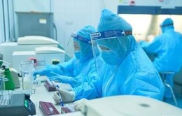 Hơn 608.800 ca COVID-19 khỏi bệnh; 1 lái xe đường dài ở Đà Nẵng dương tính với SARS-CoV-2