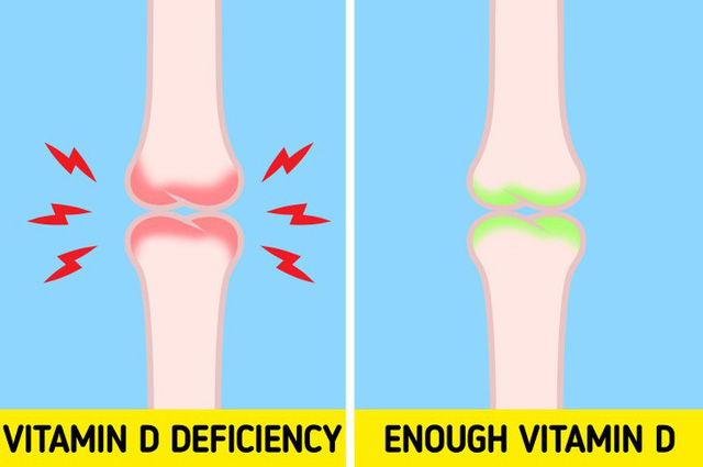 6 dấu hiệu “cảnh báo” cơ thể bạn đang thiếu Vitamin D trầm trọng