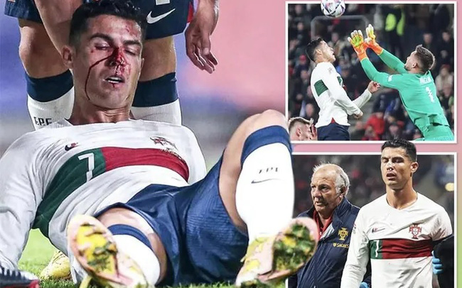 Ronaldo bị thủ môn đối phương đấm gãy mũi