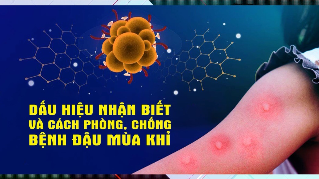 Dấu hiệu nhận biết và cách phòng chống bệnh đậu mùa khỉ