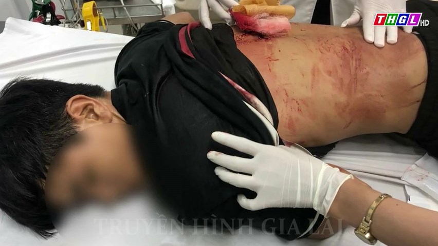 Lực lượng Cảnh sát phản ứng nhanh 113 kịp thời đưa người bị đâm thủng phổi và tràn dịch phổi đi cấp cứu